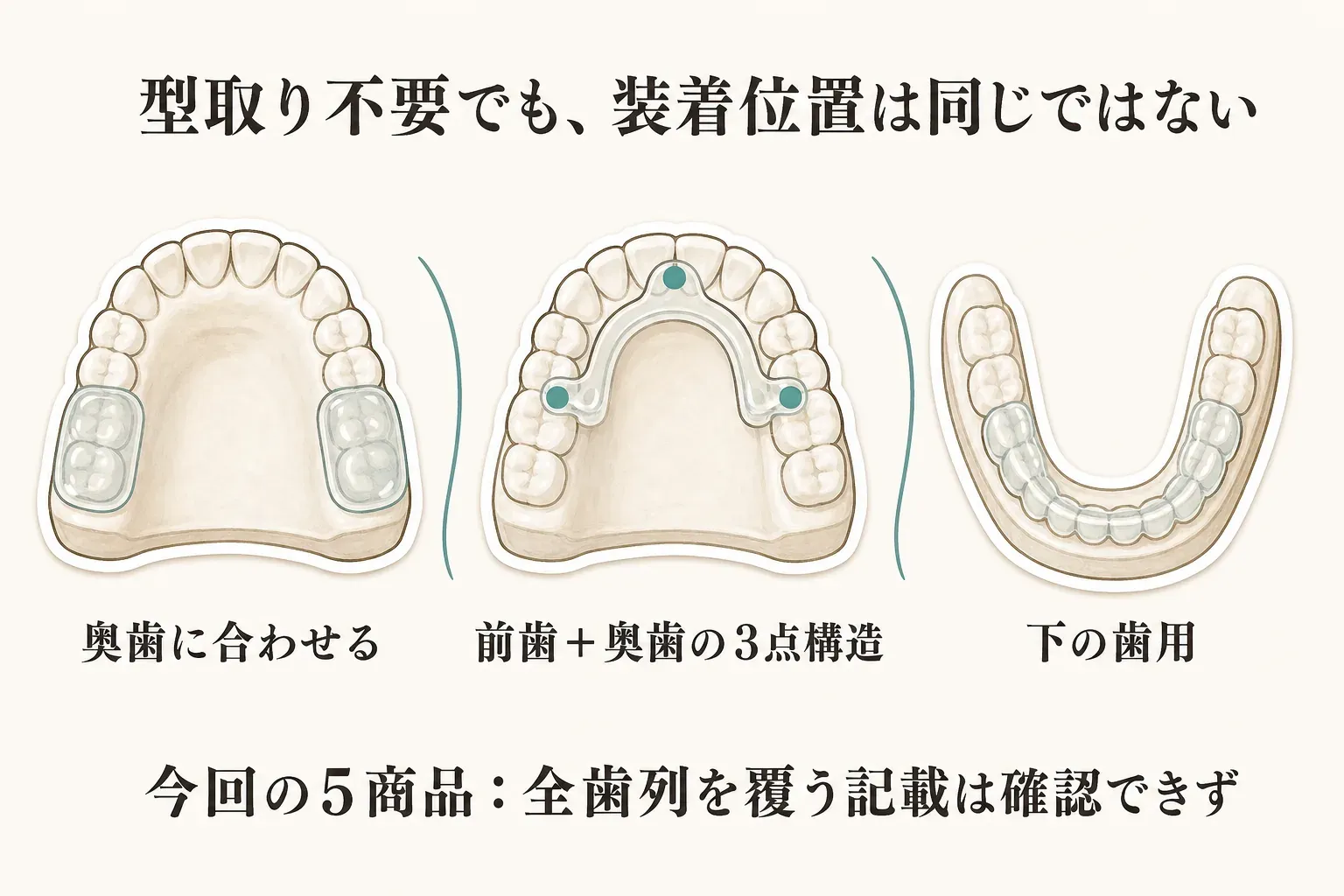 型取り不要でも装着位置が同じではないことを示す図。奥歯に合わせるタイプ、前歯と奥歯の3点構造、下の歯用を歯列図で示し、今回の5商品では全歯列を覆う記載を確認できないと説明している。
